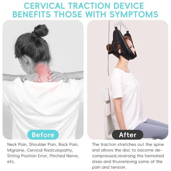 Over-The-Door Cervical Neck Traction Device (NEW IN PACK) - Picture 2 of 2